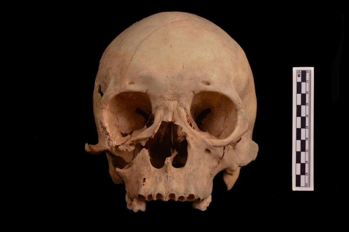 Mystery surrounding gruesome final moments of man who died 1,300 years ago is finally solved