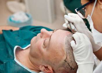 Which is the Best Hair Transplant Clinic in Turkey