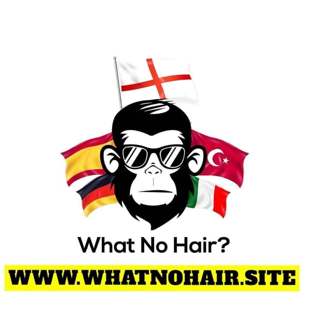 Europe's Top Hair Transplant Clinic: What No Hair Delivers Unparalleled Results