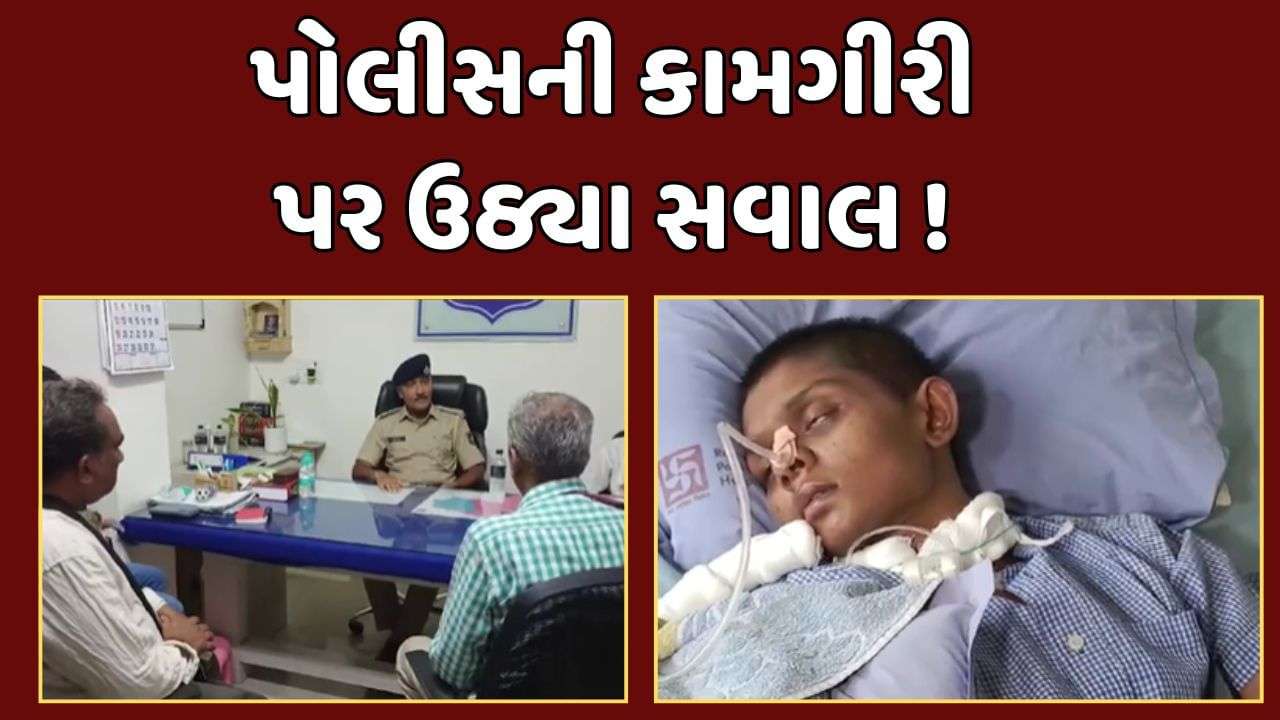 Vadodara News : Even after 85 days of the accident, the girl is under treatment, the family alleges that the police did not take proper action against the accused.