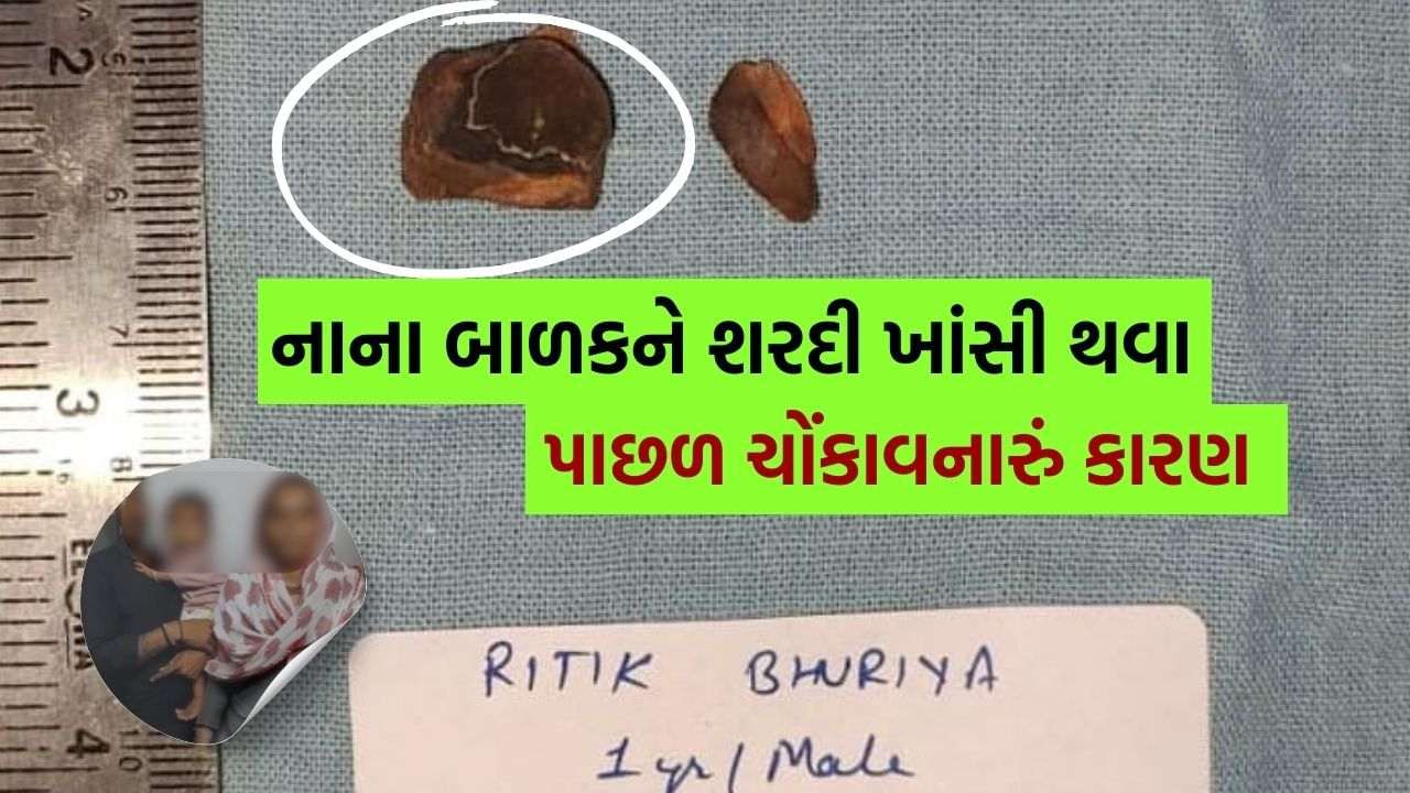 1-year-old baby was cold-cough, shocking revelation when checking esophagus, see Photo