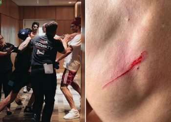 Luke Rockhold left with horror gash in backstage brawl with rival Dillon Danis just hours before Misfits 22