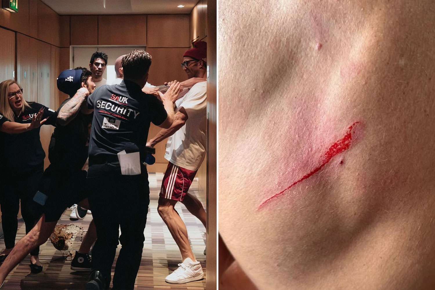 Luke Rockhold left with horror gash in backstage brawl with rival Dillon Danis just hours before Misfits 22