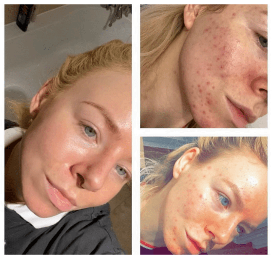 The Skincare Switch You Need This Autumn