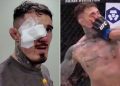‘Still can’t see’ – Worrying Tom Aspinall eye update issued after horror double poke ruins UFC 321 fight vs Ciryl Gane ‘Still can’t see’ – Worrying Tom Aspinall eye update issued after horror double poke ruins UFC 321 fight vs Ciryl Gane