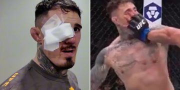 ‘Still can’t see’ – Worrying Tom Aspinall eye update issued after horror double poke ruins UFC 321 fight vs Ciryl Gane ‘Still can’t see’ – Worrying Tom Aspinall eye update issued after horror double poke ruins UFC 321 fight vs Ciryl Gane