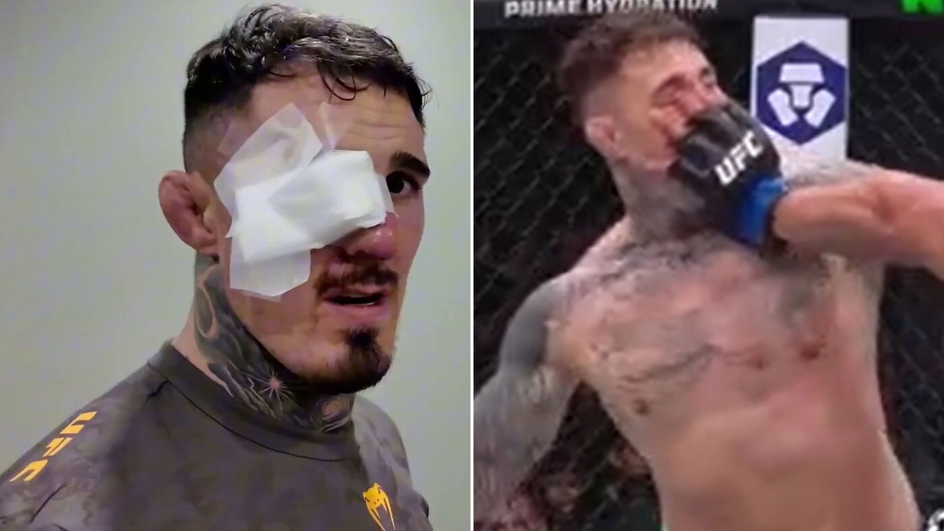 ‘Still can’t see’ – Worrying Tom Aspinall eye update issued after horror double poke ruins UFC 321 fight vs Ciryl Gane