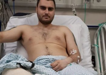 Darts pro who lost leg in ‘work accident’ fails in £1m compo bid after he asked docs to sever limb for ‘no good reason’